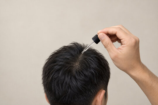スポイトで頭頂部の頭皮にケア液を一滴塗布する日本人男性