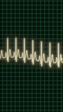 Vertical ECG heart rate monitor animation with pulsing waveform at 150 bpm on green grid. Fitness cardiology looping motion graphic for health, workout, and medical themes.