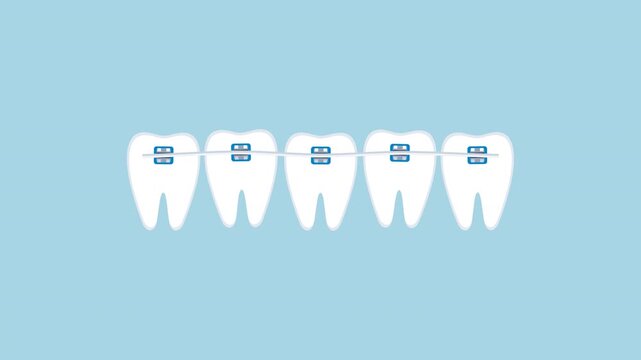 Dental braces aligning crooked teeth animation on blue background