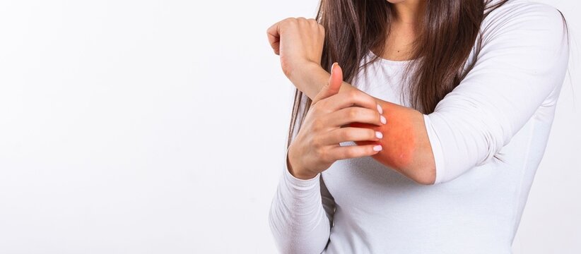 Young woman suffering from elbow pain, holding forearm with inflamed joint highlighted in red, arthritis and tendonitis concept