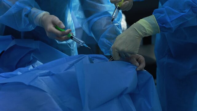 Ophthalmic surgery close up, medical team using syringes with fine cannulas and surgical instruments during eye operation, patient covered with blue drape