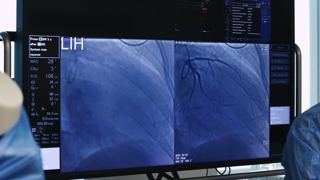 Angiography system screen showing contrast filled coronary arteries during interventional cardiology procedure in modern hospital