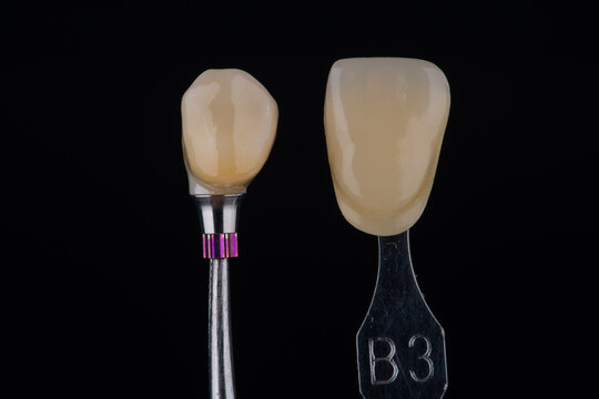 Single dental zirconia crown of premolar on a titanium base compared to shade B3