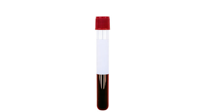 Medical test tube with red cap and blood sample on transparent background
