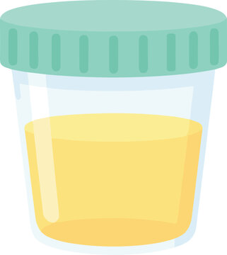 Urine Sample Cup with Green Lid for Medical Test
