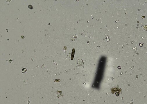 soil microorganisms under a microscope including amoeba, flagellates, nematodes, fungi, bacteria