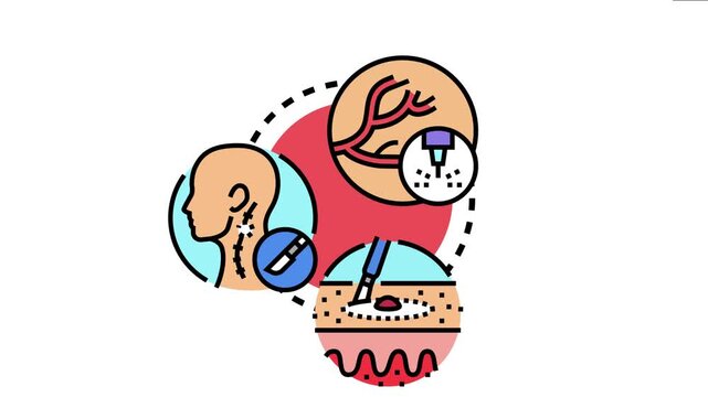 Medical specialists performing neoplasm excising procedure, utilizing laser technology and surgical instruments to eradicate unhealthy cells and regenerate health