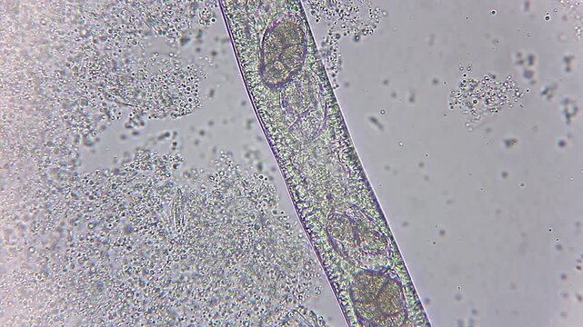 Active internal eggs developing inside a transparent nematode roundworm under 400x brightfield microscopy 4K