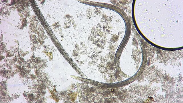 Nematode roundworms crawling near a large round air bubble under 100x brightfield microscopy