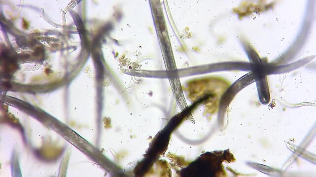 Densely packed nematode colony wriggling through organic detritus under 100x brightfield microscopy