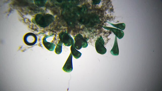 Wide view colony of blue-green Stentor ciliates attached to substrate under 40x brightfield microscopy