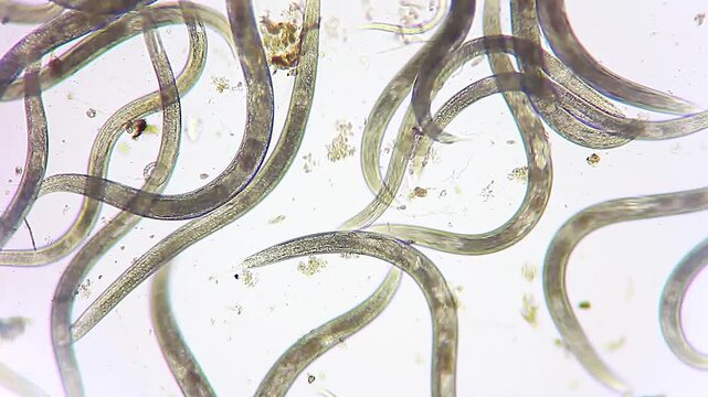 Dense colony of active nematode roundworms wriggling in dirty water drop under 100x brightfield microscopy