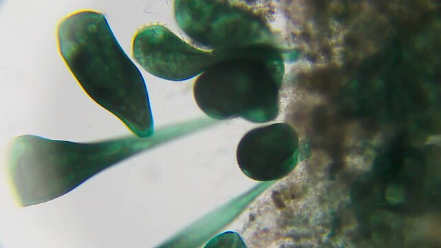 Colony of blue-green Stentor ciliates attached to substrate feeding on bacteria under 100x brightfield microscopy