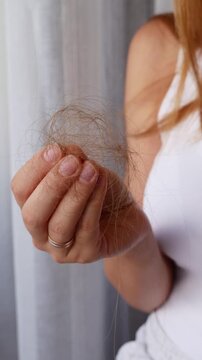 Close-up of woman holding large clump of fallen hair showing excessive hair loss and shedding problem