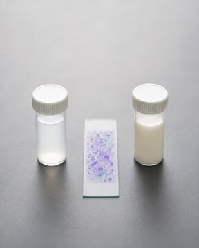 Milk somatic cell testing - a comparative count quality arrangement with vials