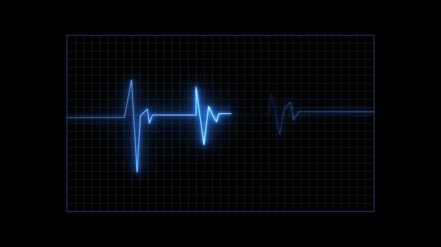 Animated electrocardiogram display shows pulsing blue heart rhythm on dark grid background, medical waveform monitoring motion graphic.