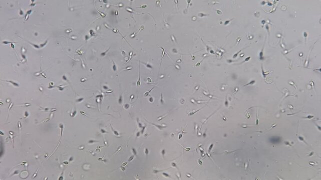 Microscopic footage of semen normozoospermia sperm count. Normal semen analysis on microscopic examination.