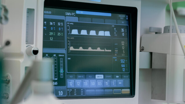 Medical patient monitor screen in hospital intensive care unit showing vital signs, waveform graphs, numeric readings, and ventilation data beside clinical equipment under soft indoor light