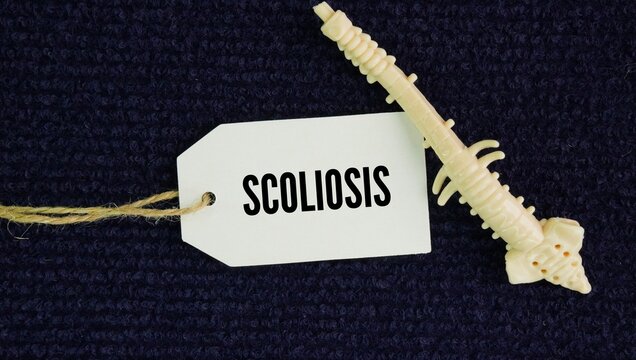 Human spine and paper with the word Scoliosis is a medical condition defined by an abnormal sideways curvature and twisting of the spine, usually forming an S- or C-shape.