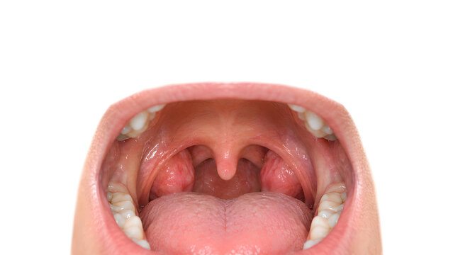 Palatine tonsils with mild tonsillitis concept in an open mouth, photorealistic medical education image on a white background with copy space for ENT care, patient information and healthcare design