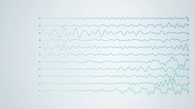 Blue EEG brain wave recording starting on a monitor