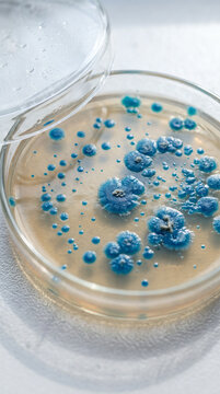 Blue microbial colonies grow on agar medium inside an open petri dish, used for laboratory microbiological observation.