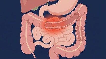 Obraz premium Medical illustration of human digestive system anatomy with highlighted colon inflammation area