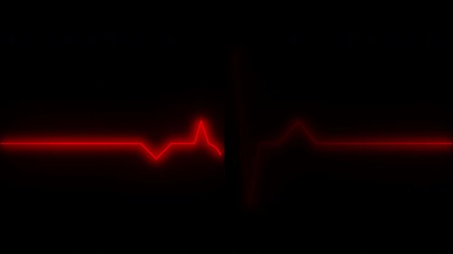 Cardiograph recording pulse featuring heartbeat flatline on black background. 4k animation