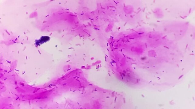 HVS for gram stain. Gram positive bacilli resembling lactobacilli. Microscopic footage. 