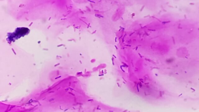 HVS for gram stain. Gram positive bacilli resembling lactobacilli. Microscopic footage. 