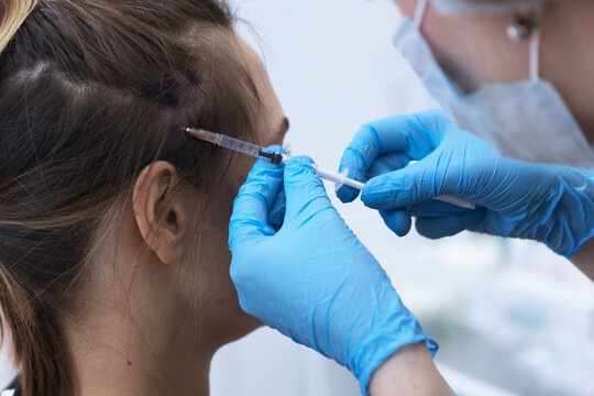 Cosmetologist injects Botox into patient's scalp in hair-bearing area, near temple. Product is injected into specific facial muscles to induce relaxation. Specialist is wearing mask and blue gloves