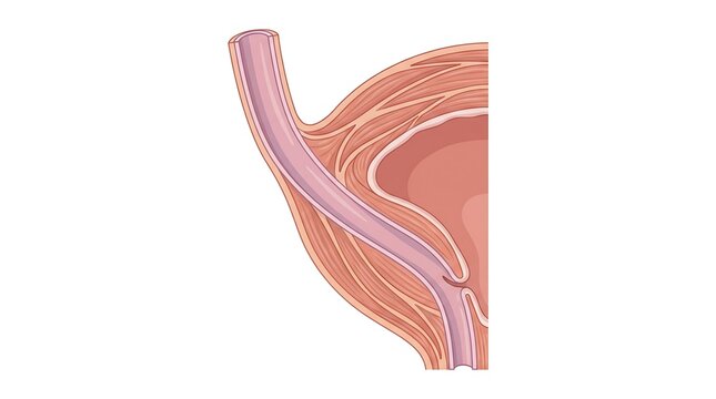 Ureterovesical junction anatomy at the bladder entrance