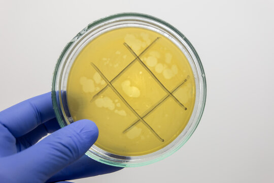 A Petri dish marked into sectors showing bacterial cell lysis caused by an active bacteriophage.
