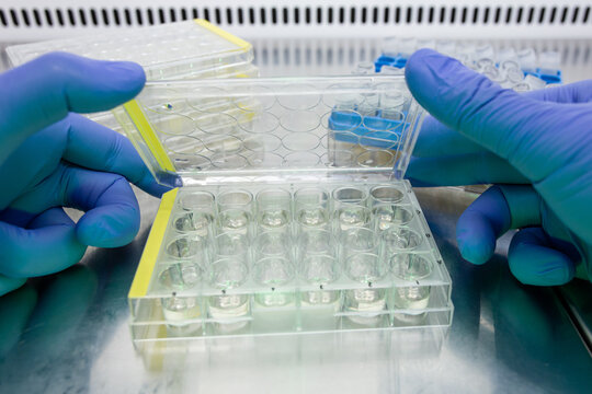 A close-up shot shows a scientist lifting the lid of an immunological plate to reveal samples containing human cell cultures. Stem cell research in a laboratory.