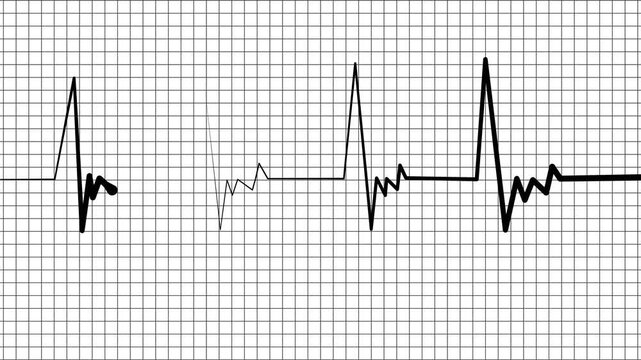Heart monitor line medical pulse pattern with a flat section and sharp spikes animation