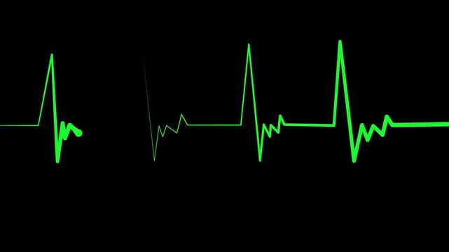 Heart monitor line medical pulse pattern with a flat section and sharp spikes animation