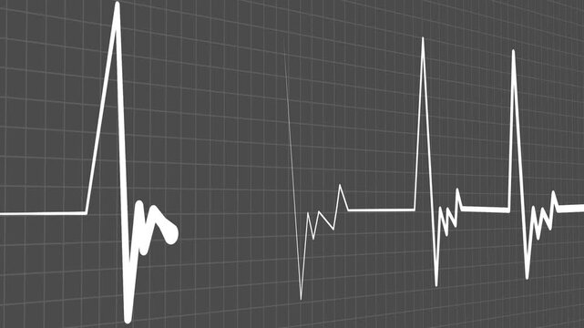 Heart monitor line medical pulse pattern with a flat section and sharp spikes animation