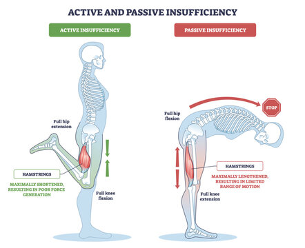 Active vs passive insufficiency shown with skeletons, hamstrings at extremes limit force and range in hip and knee moves, key objects are hamstrings, skeleton, arrows. Outline diagram