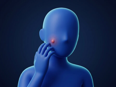 3D Illustration of a Person with Swollen Neck Gland