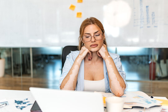 Neck and shoulder pain. Office syndrome, Healthcare and body problem concept. Young businesswoman sitting at the desk, feeling neck muscle tension and exhaustion while working on a laptop.