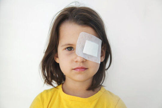 Little girl with brown hair in yellow t-shirt wearing white eye patch, occlusion therapy for amblyopia, lazy eye or strabismus, concept of pediatric ophthalmology, vision correction, eye care