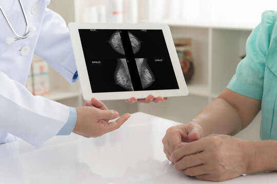 Breast Surgeon doctor looks result of mammography to screen diagnose breast from mammogram test at medical center.