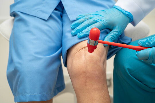 Asian doctor knock on knee reflex nerve for check and treatment senior patient in hospital.