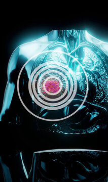 Conceptual 3D illustration of lung cancer and tumor growth in the lungs