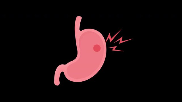 Stomach pain animation with inflamed stomach on transparent background