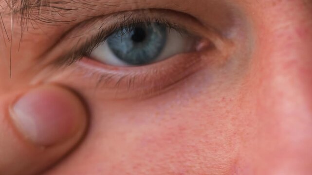 Contact lens putting into blue eye extreme macro close up, man inserting soft lens with UV protection, eye care, vision correction and ophthalmology medicine