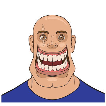 A man with an expressive, caricatured, and striking look, characterized by an exaggerated smile revealing his teeth, a bald head, a scar over his eye, and highly expressive features.