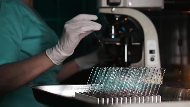 Laboratory scientist takes a prepared sample slide and places it under a microscope for examination. Scientific research, microscopy and laboratory analysis process.