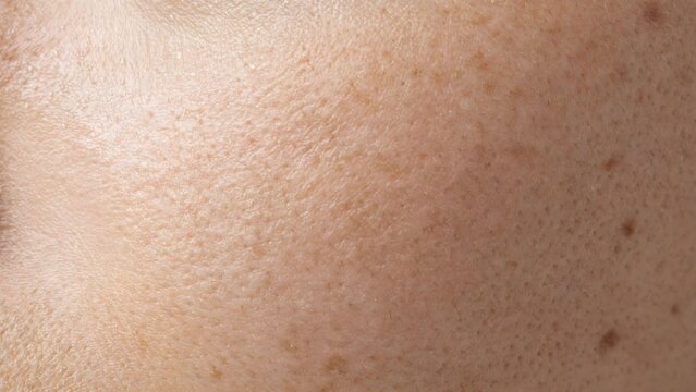 Close up view of human skin texture with visible pores and freckles for dermatology and beauty