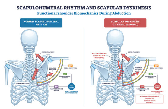 Scapulohumeral rhythm and scapular dyskinesis compared in a brief shoulder mechanics chart, highlighting scapula, humerus, and trapezius during abduction. Outline diagram